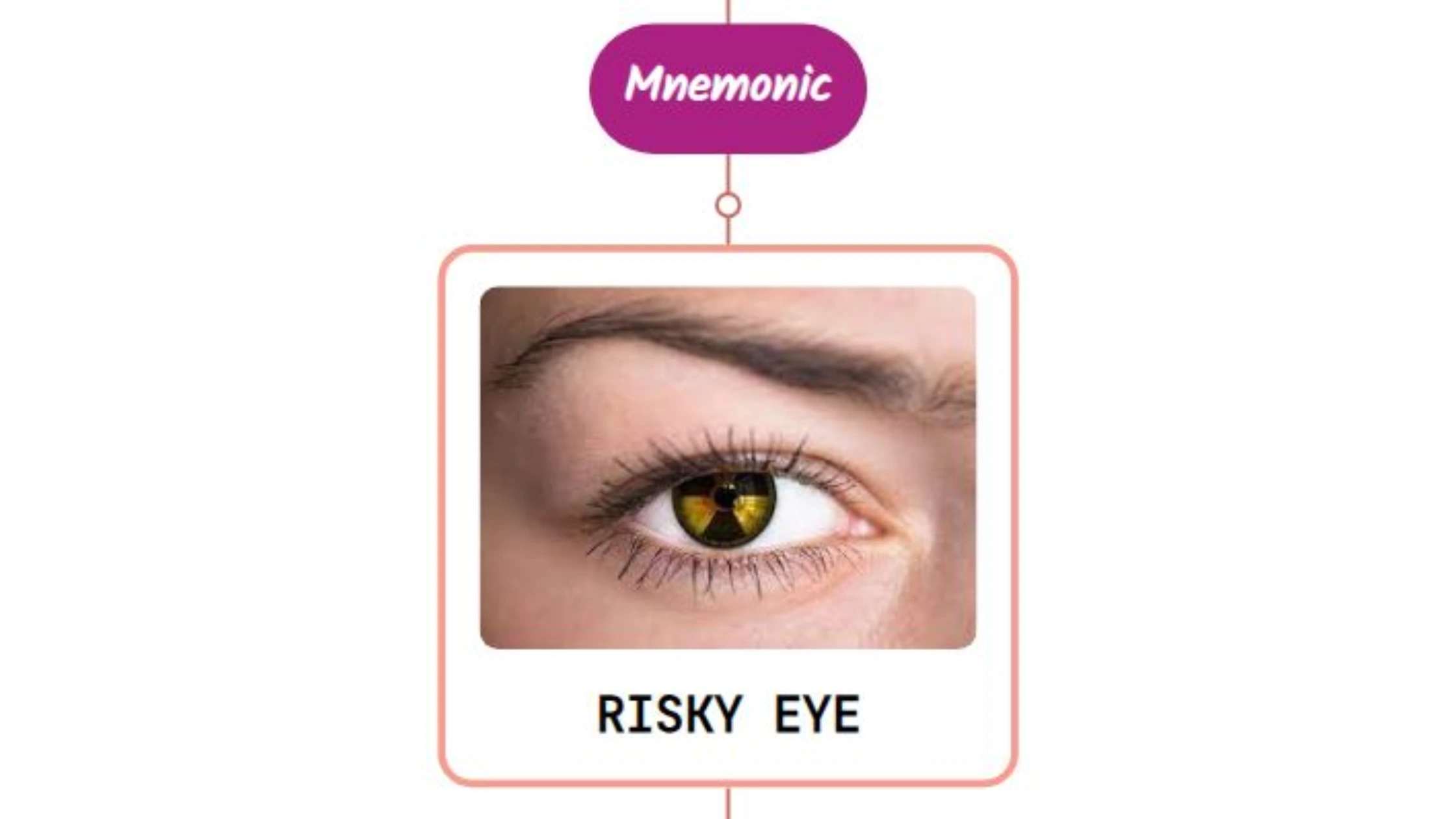 You are currently viewing Keratitis Mnemonic