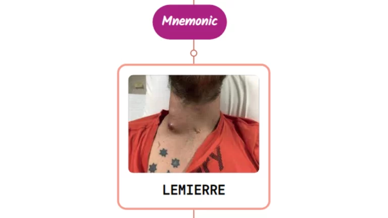 Read more about the article Lemierre’s Syndrome – Mnemonic