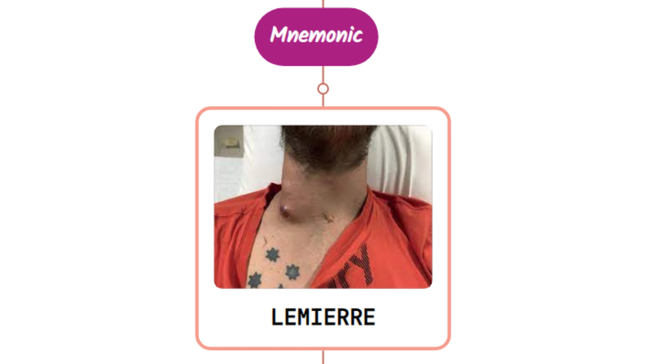 You are currently viewing Lemierre’s Syndrome – Mnemonic