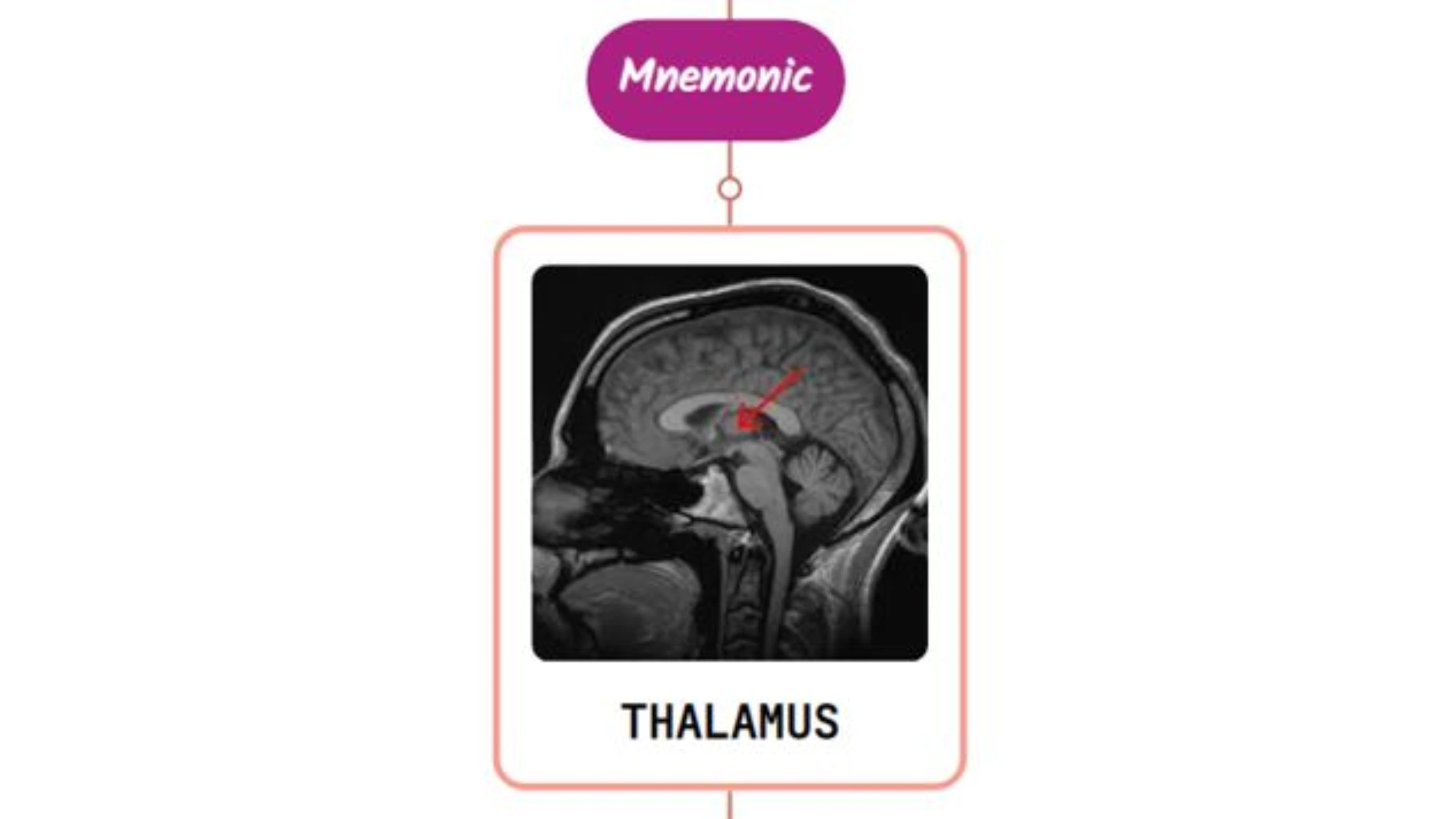 You are currently viewing Localization Of Sensory Abnormalities To Thalamus Mnemonic