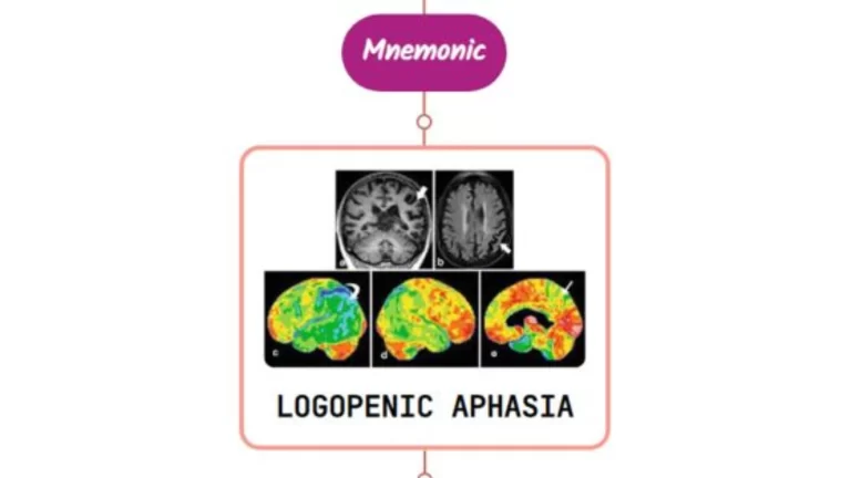 Read more about the article Logopenic Primary Progressive Aphasia Mnemonic