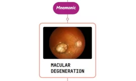 Macular Degeneration – Mnemonic
