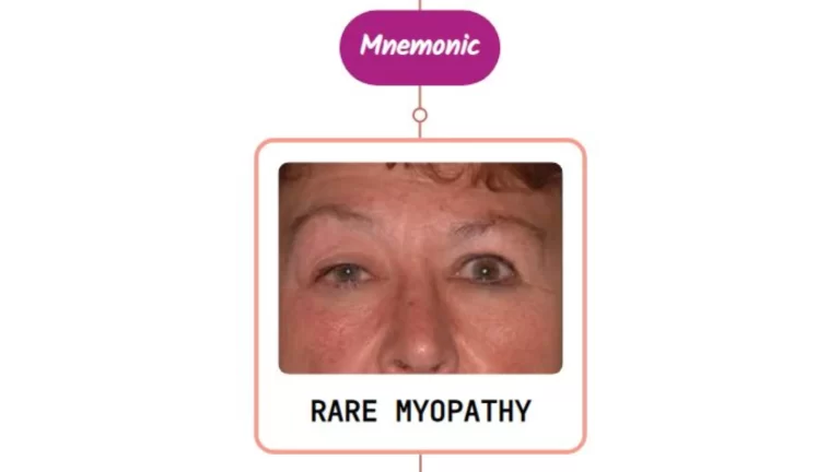 Read more about the article Myogenic Ptosis – Mnemonic