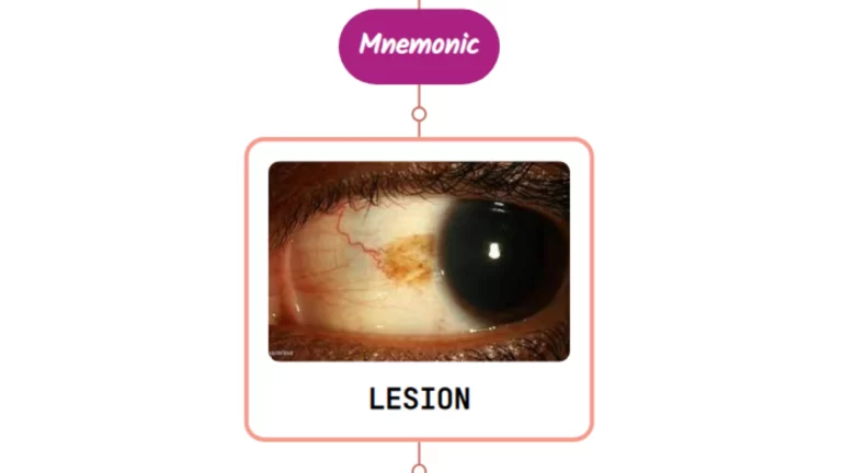 Read more about the article Neurogenic Ptosis – Mnemonic