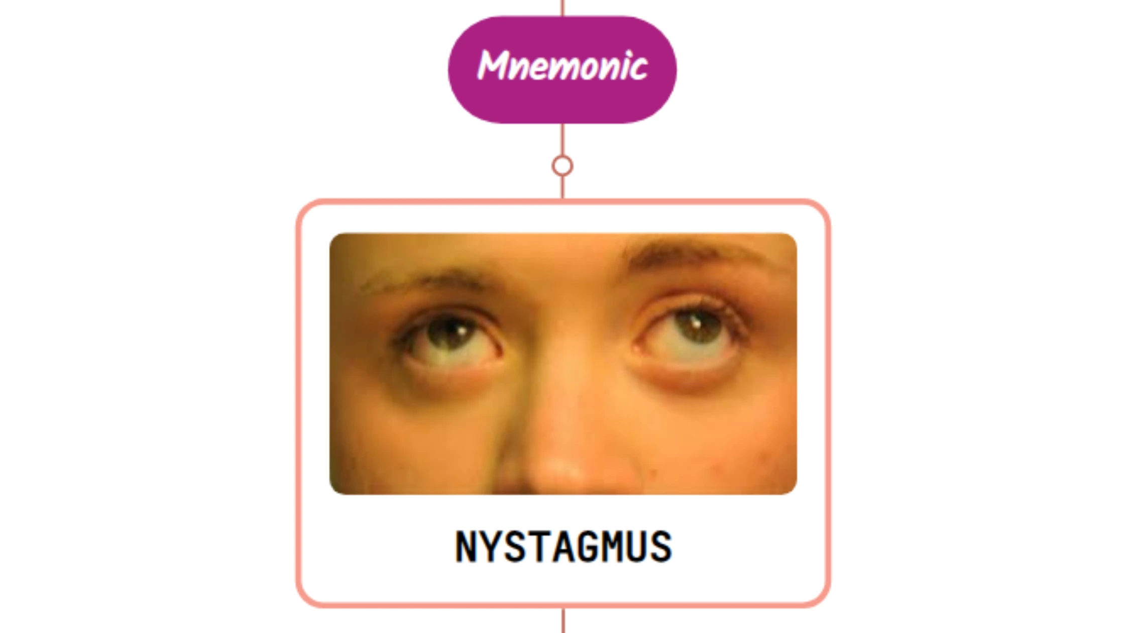 You are currently viewing Nystagmus – Mnemonic