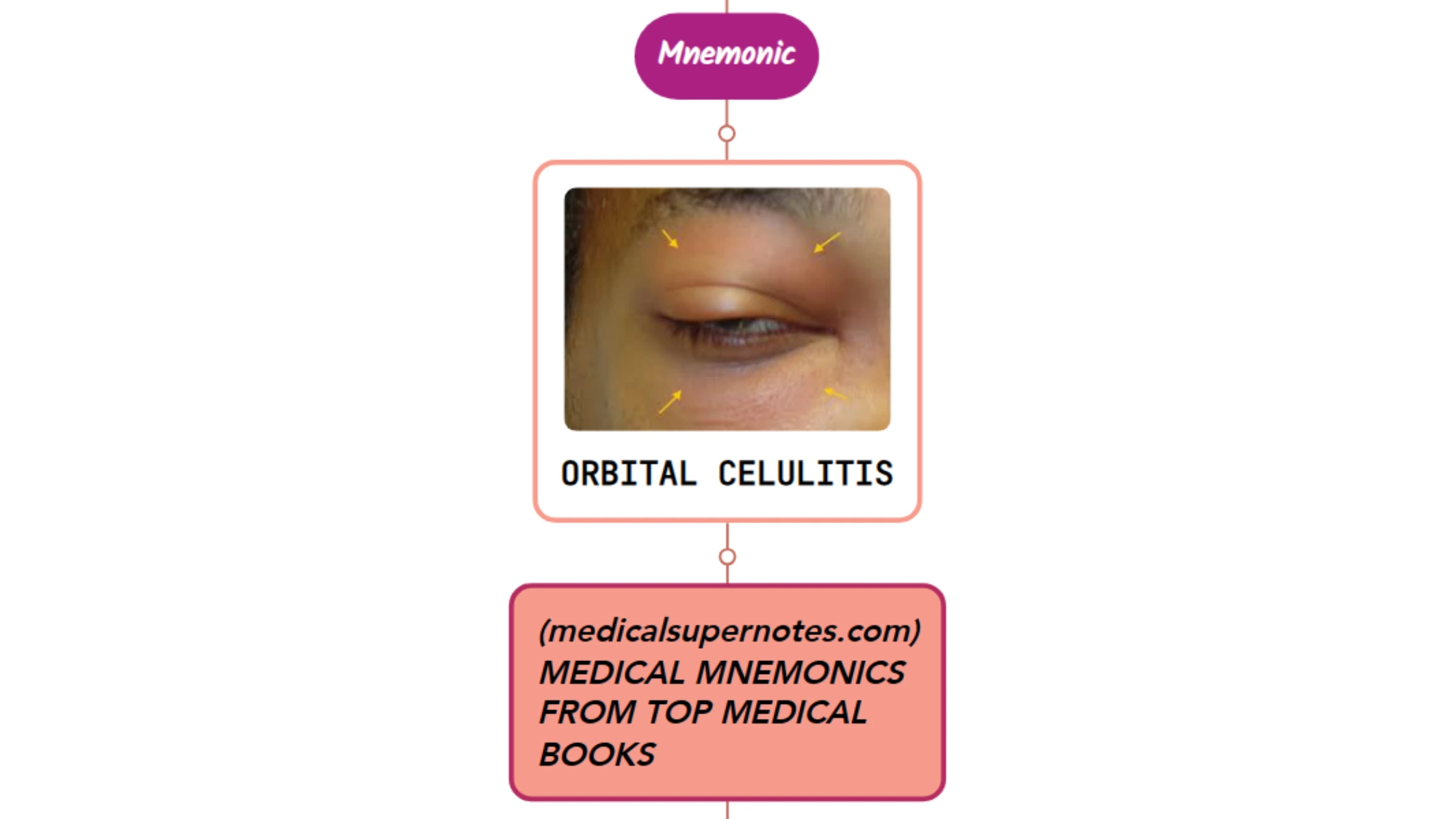 You are currently viewing Orbital Cellulitis – Mnemonic
