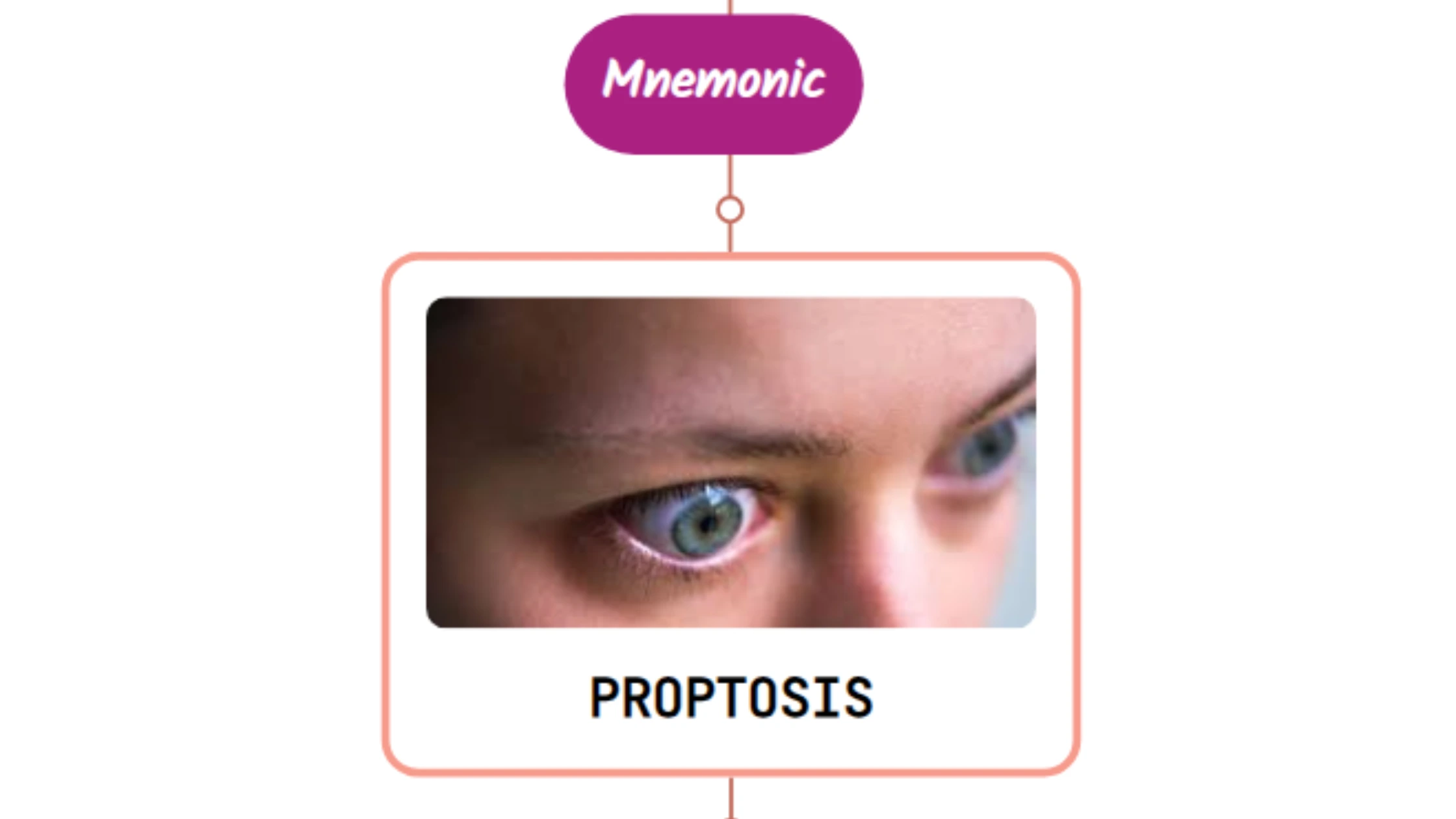 You are currently viewing Proptosis Of Eye – Mnemonic