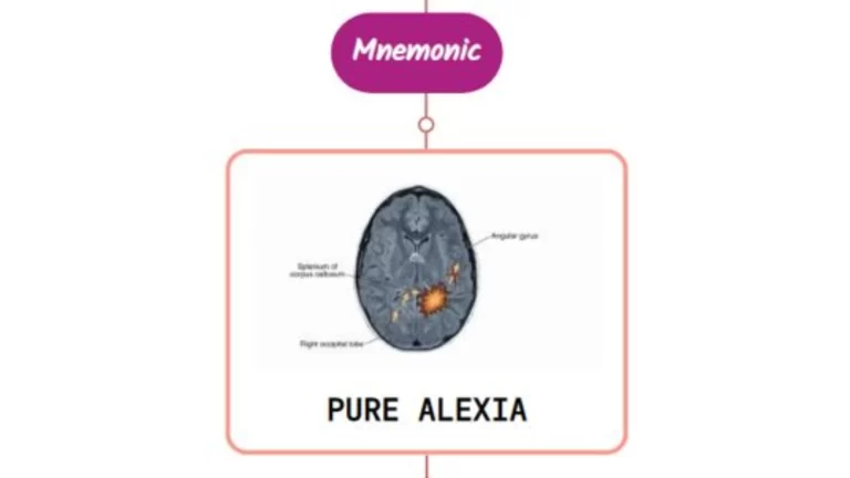 Read more about the article Pure Alexia Without Agraphia Mnemonic