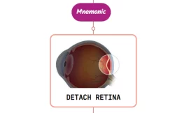 Retinal Detachment Mnemonic