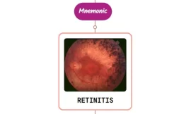 Retinitis Pigmentosa – Mnemonic