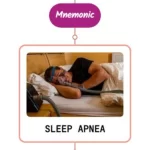Read more about the article Sleep Apnea Syndrome Mnemonic
