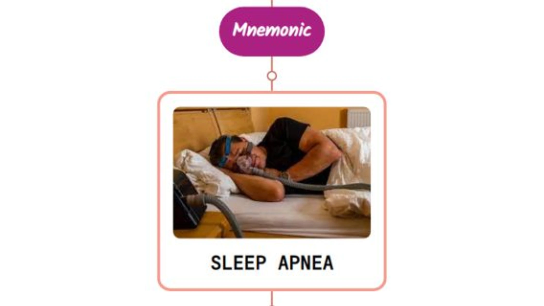 You are currently viewing Sleep Apnea Syndrome Mnemonic