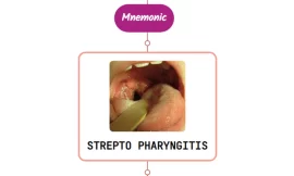 Streptococcal Pharyngitis – Mnemonic