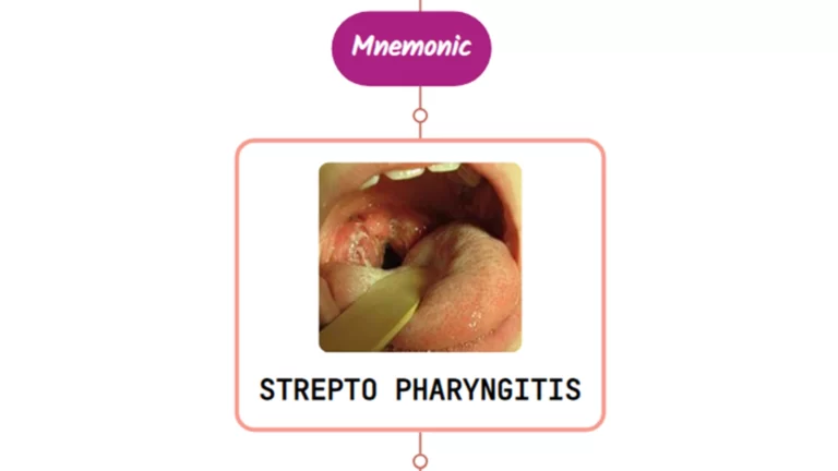 Read more about the article Streptococcal Pharyngitis – Mnemonic