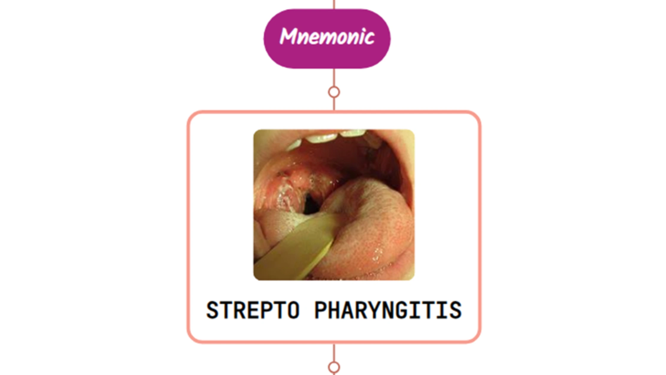 You are currently viewing Streptococcal Pharyngitis – Mnemonic