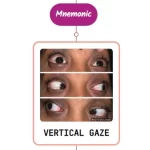 Read more about the article Supranuclear Disorders of Gaze – Mnemonic