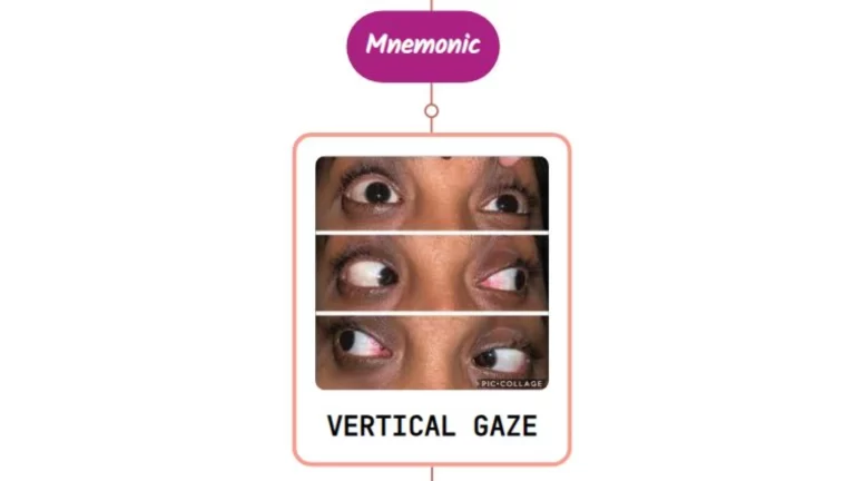 Read more about the article Supranuclear Disorders of Gaze – Mnemonic