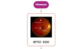 Toxic Optic Neuropathy Mnemonic