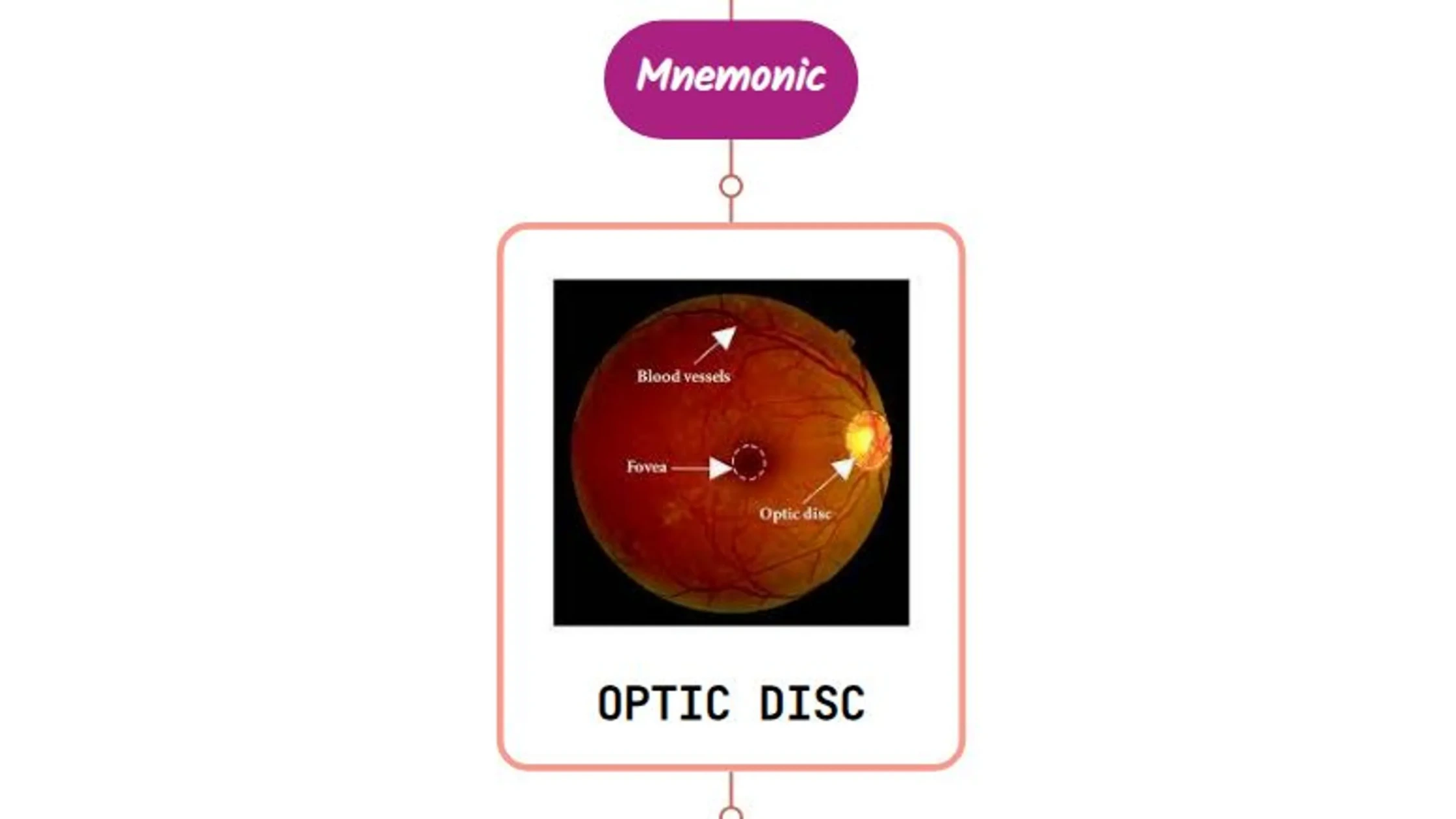 You are currently viewing Toxic Optic Neuropathy Mnemonic