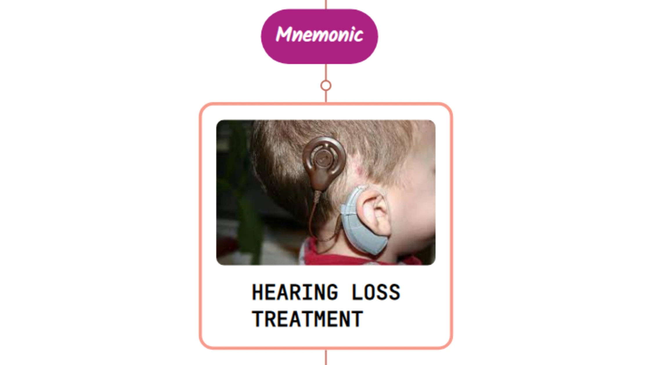 You are currently viewing Treatment Of Disorders of the Sense of Hearing – Mnemonic