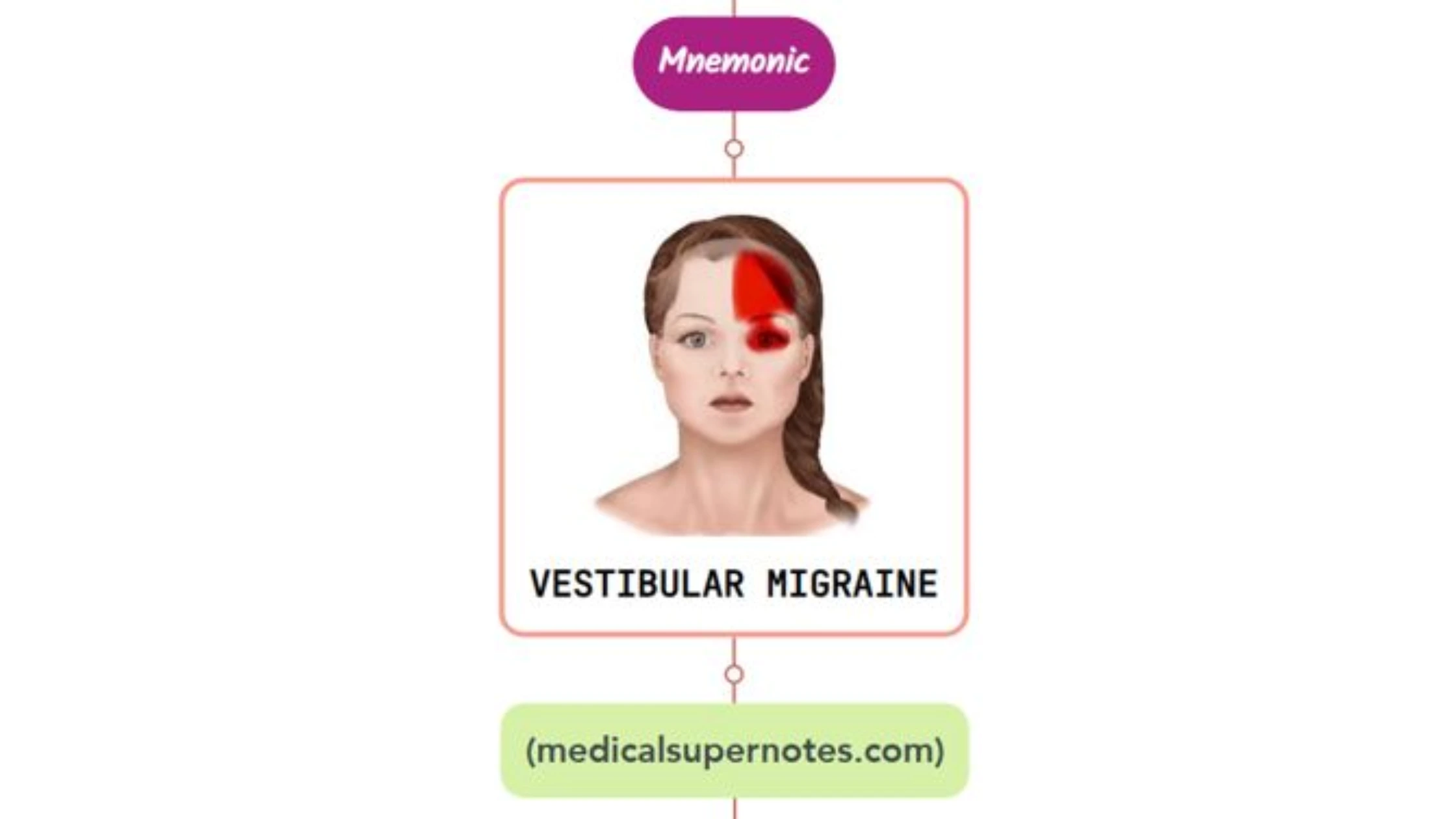 You are currently viewing Vestibular Migraine Mnemonic