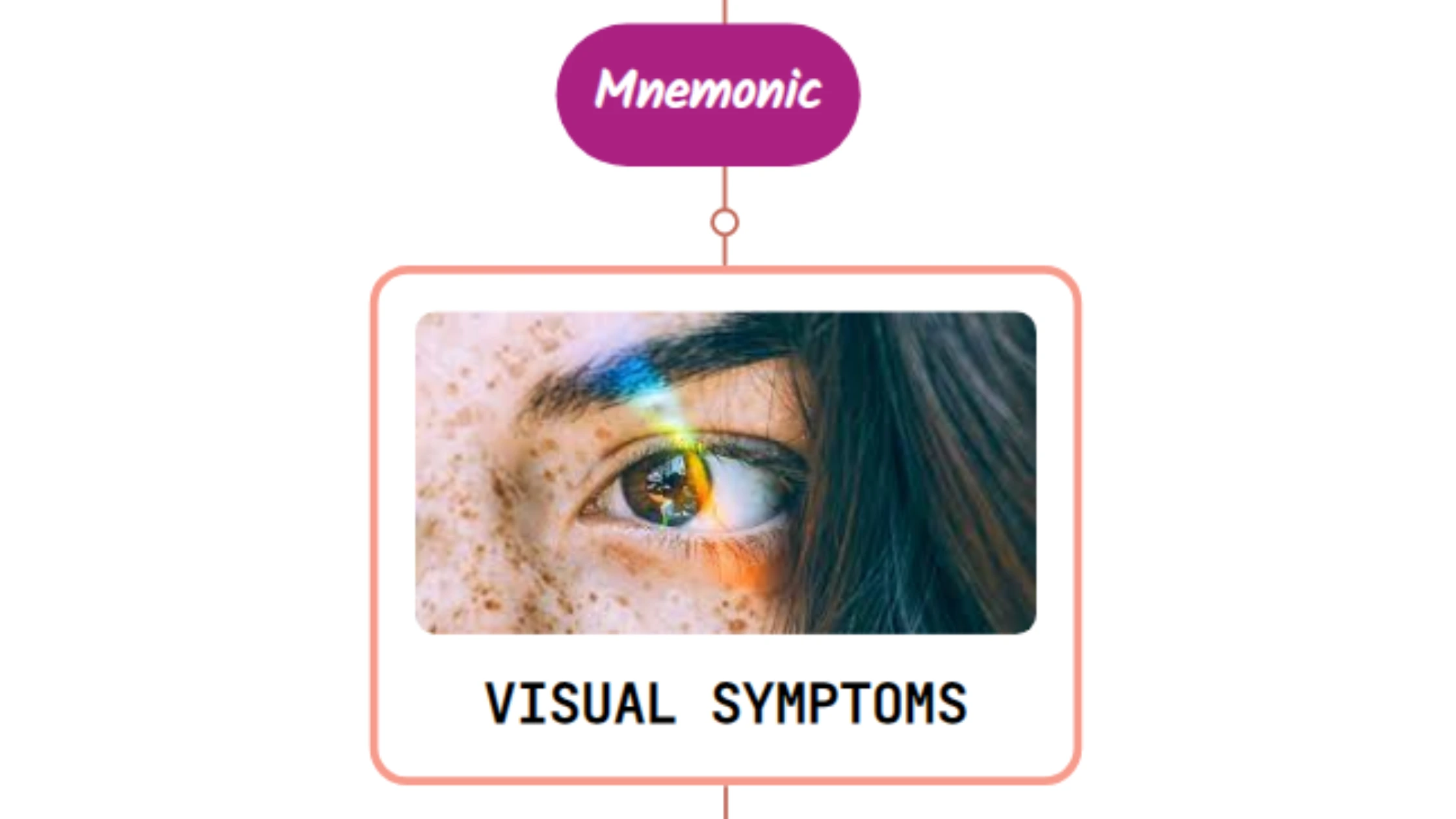 You are currently viewing Vitreous Degeneration Mnemonic