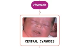 Central Cyanosis – Mnemonic