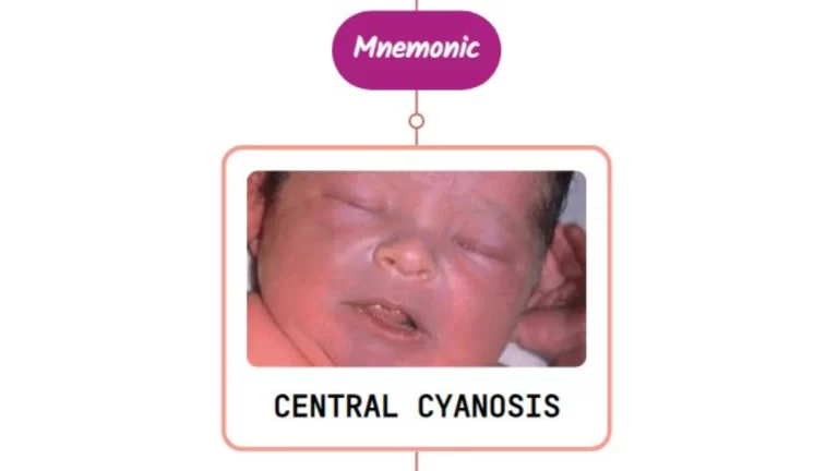 Read more about the article Central Cyanosis – Mnemonic