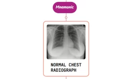Chronic Cough With A Normal Chest Radiograph – Mnemonic