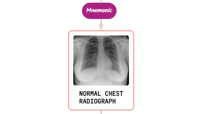 Read more about the article Chronic Cough With A Normal Chest Radiograph – Mnemonic