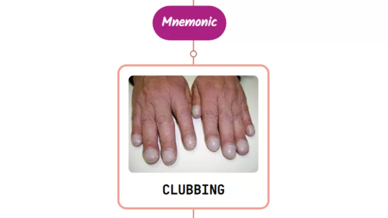 Read more about the article Clubbing – Mnemonic