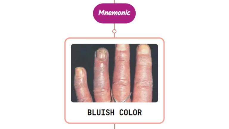 Read more about the article Cyanosis – Mnemonic