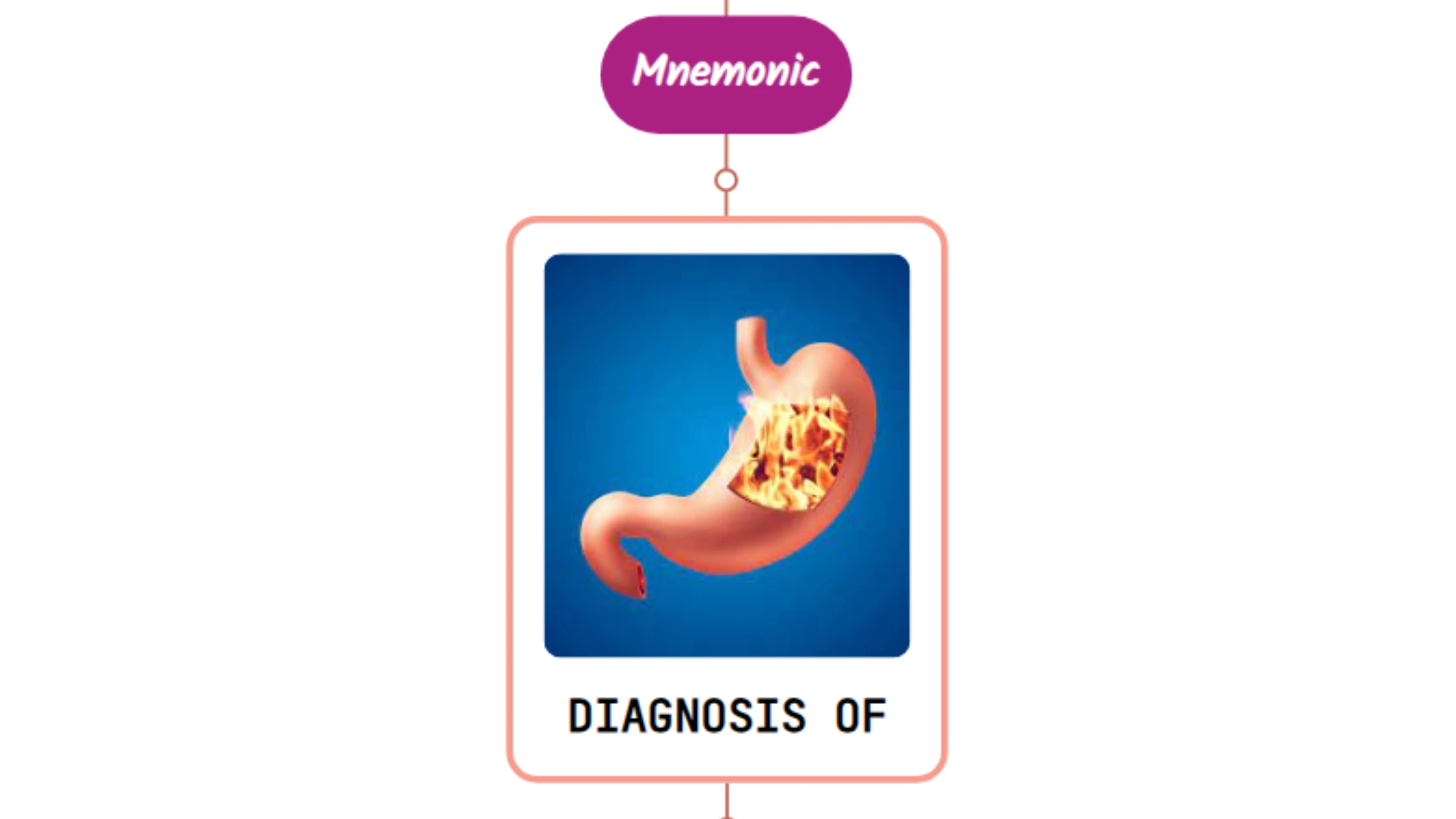 You are currently viewing Differential Diagnosis Of Indigestion – Mnemonic