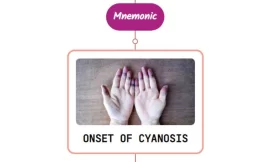Evaluation Of Cyanosis – Mnemonic