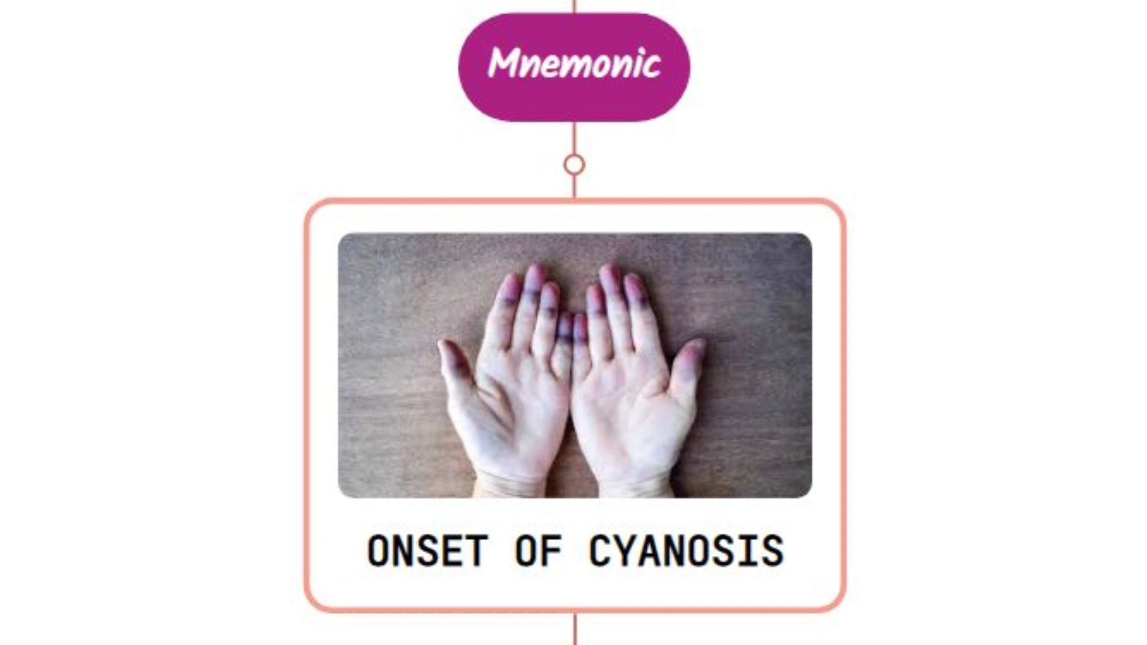 You are currently viewing Evaluation Of Cyanosis – Mnemonic