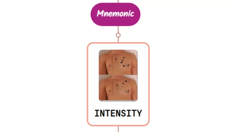 Read more about the article Intensity Of Heart Murmur – Mnemonic