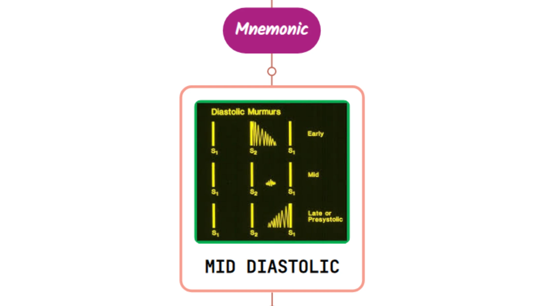 You are currently viewing Mid-Diastolic Murmurs – Mnemonic