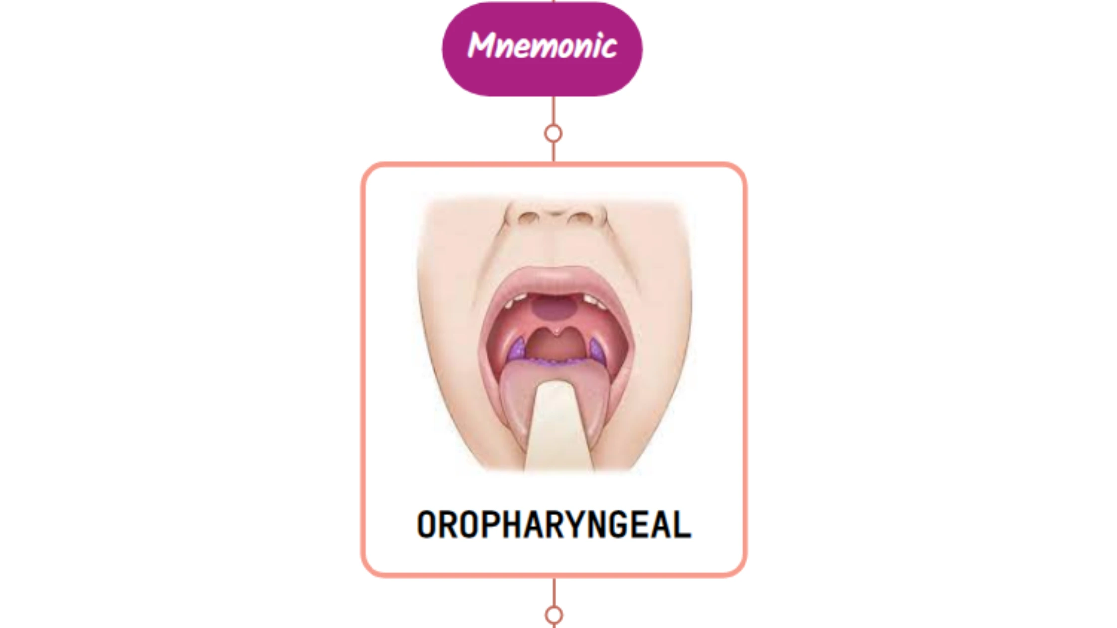 You are currently viewing Oropharyngeal Dysphagia Mnemonic
