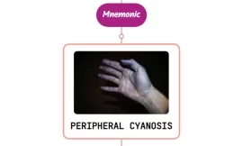 Peripheral Cyanosis – Mnemonic