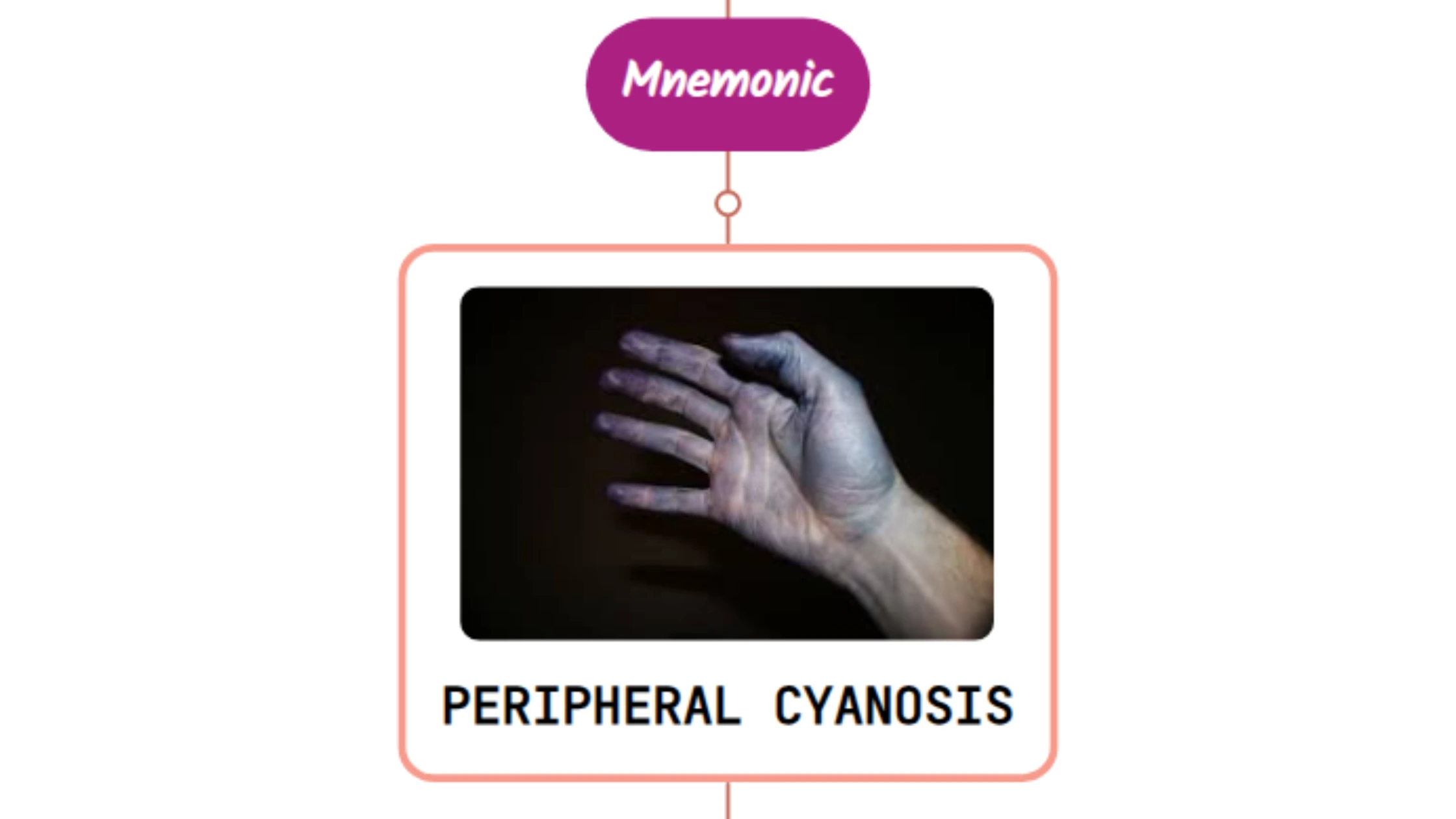 You are currently viewing Peripheral Cyanosis – Mnemonic
