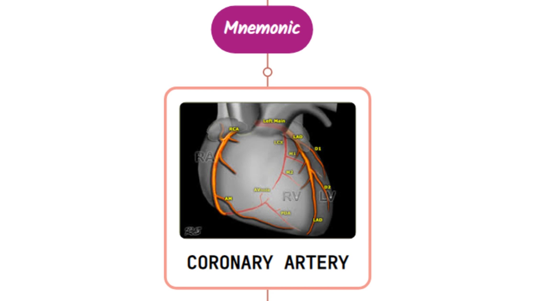 You are currently viewing Coronary Artery – Mnemonic [ NEVER FORGET AGAIN ]