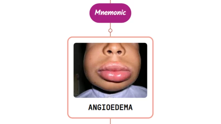 Read more about the article Drugs Causing Angioedema⚡Mnemonic⚡