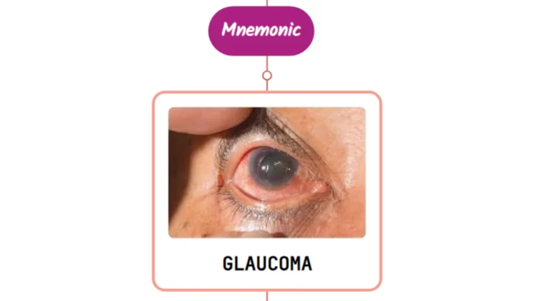 Read more about the article Drugs Causing Angle Closure Glaucoma⚡Mnemonic⚡