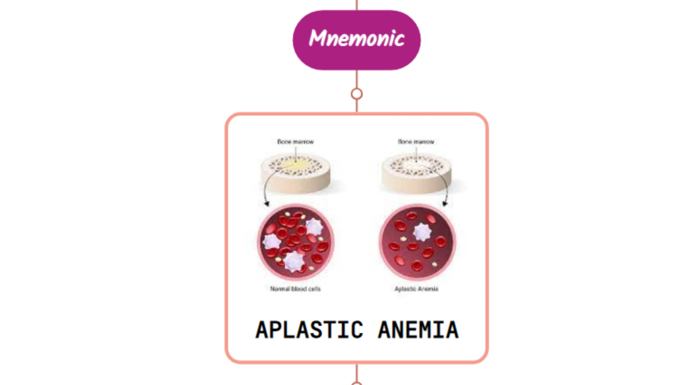 You are currently viewing Drugs Causing Aplastic Anemia⚡Mnemonic⚡