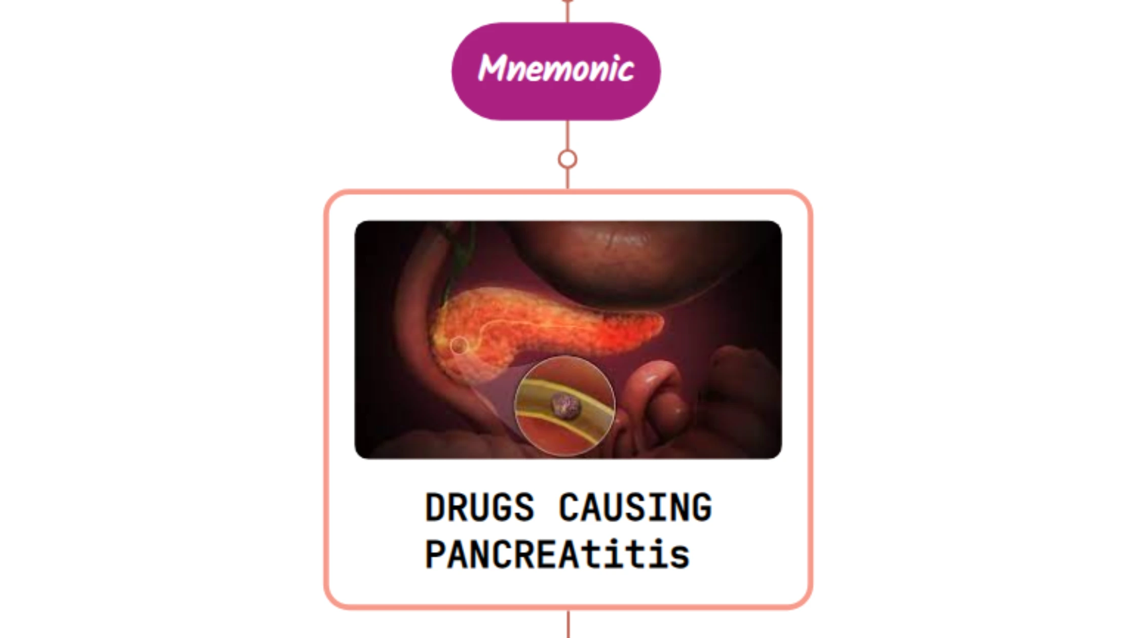 You are currently viewing Drugs Causing Pancreatitis ⚡Mnemonic⚡