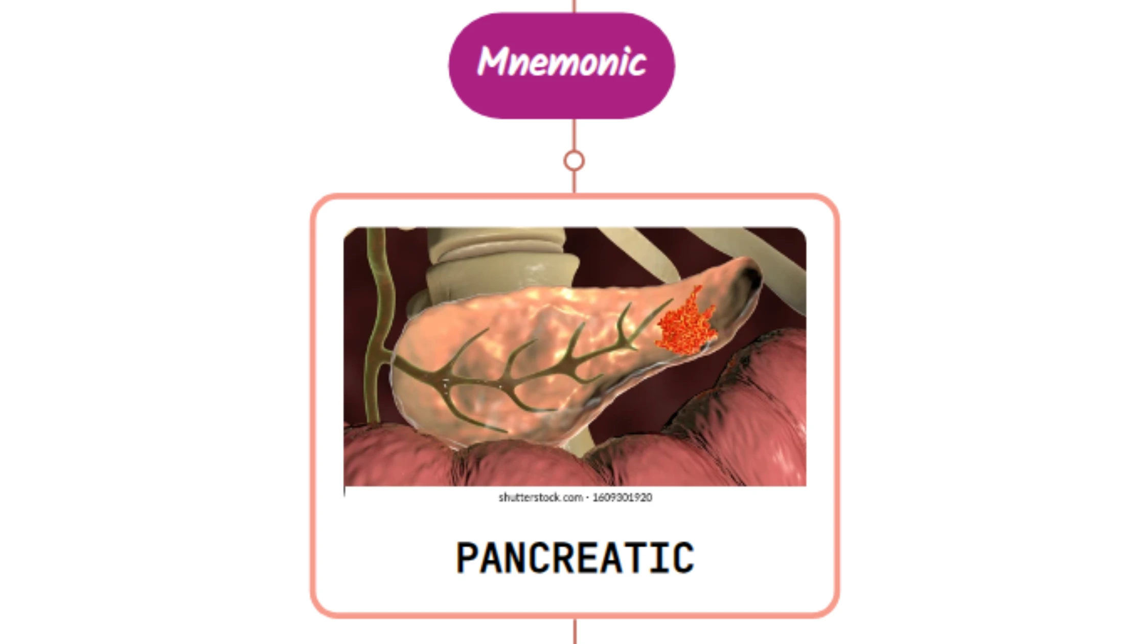 You are currently viewing Inferior Pancreaticoduodenal Artery – Mnemonic [ NEVER FORGET AGAIN ]