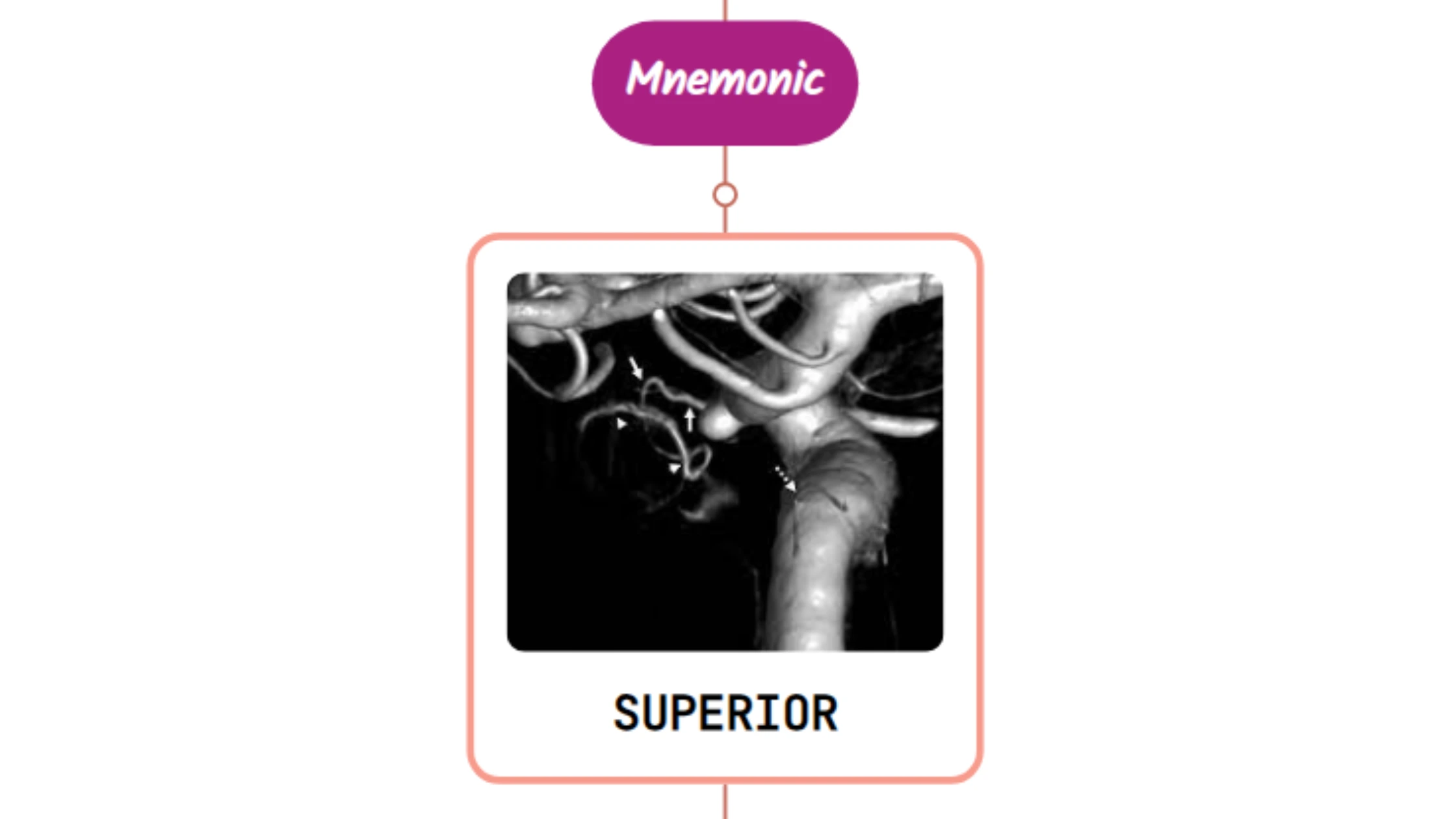 You are currently viewing Superior Hypophyseal Artery Mnemonic ⚡NEVER FORGET⚡