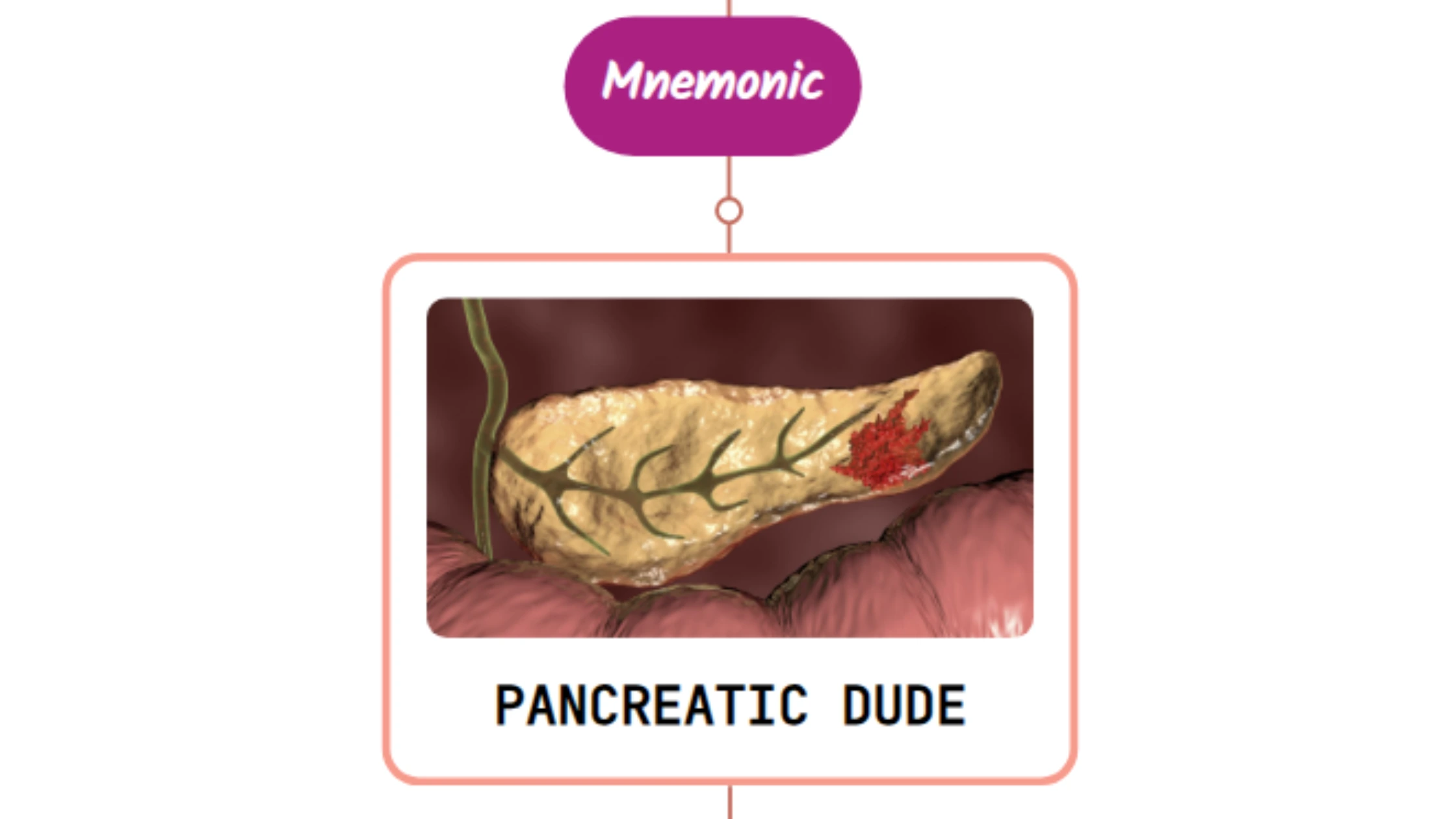 You are currently viewing Superior Pancreaticoduodenal Artery – Mnemonic [ NEVER FORGET AGAIN ]